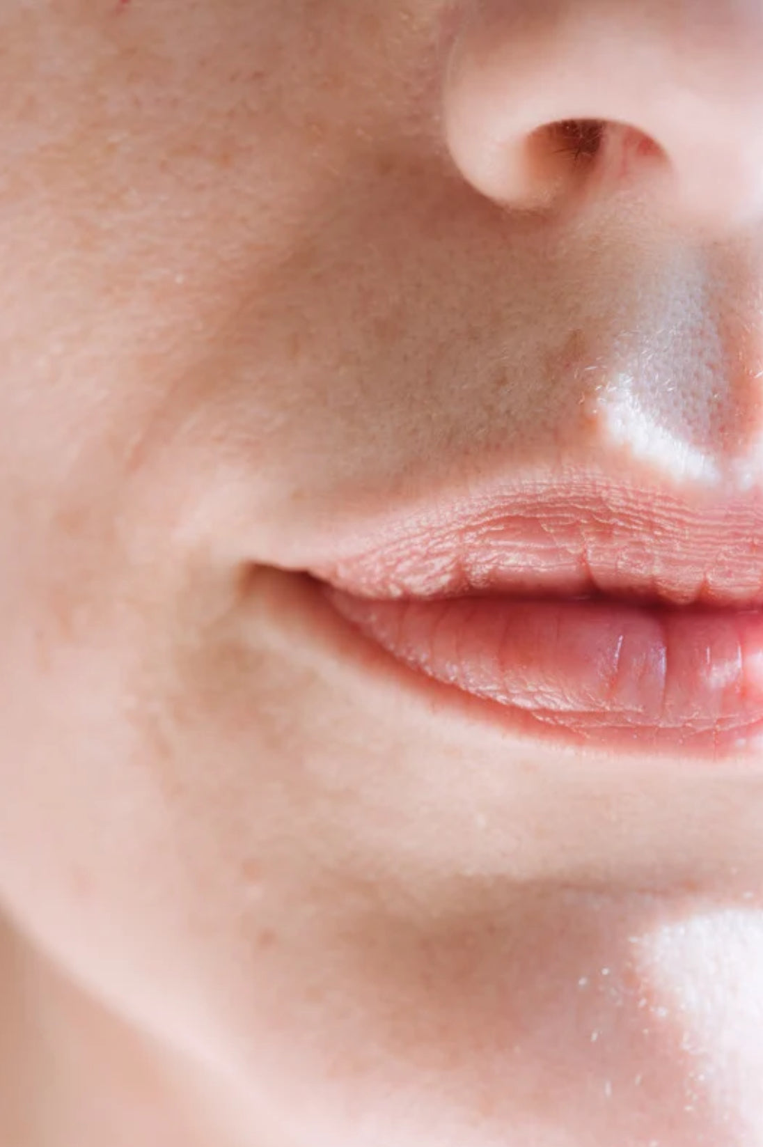 Lip Filler