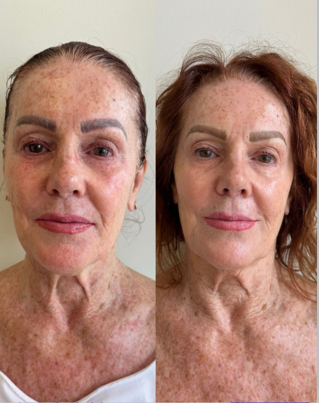 Before and After