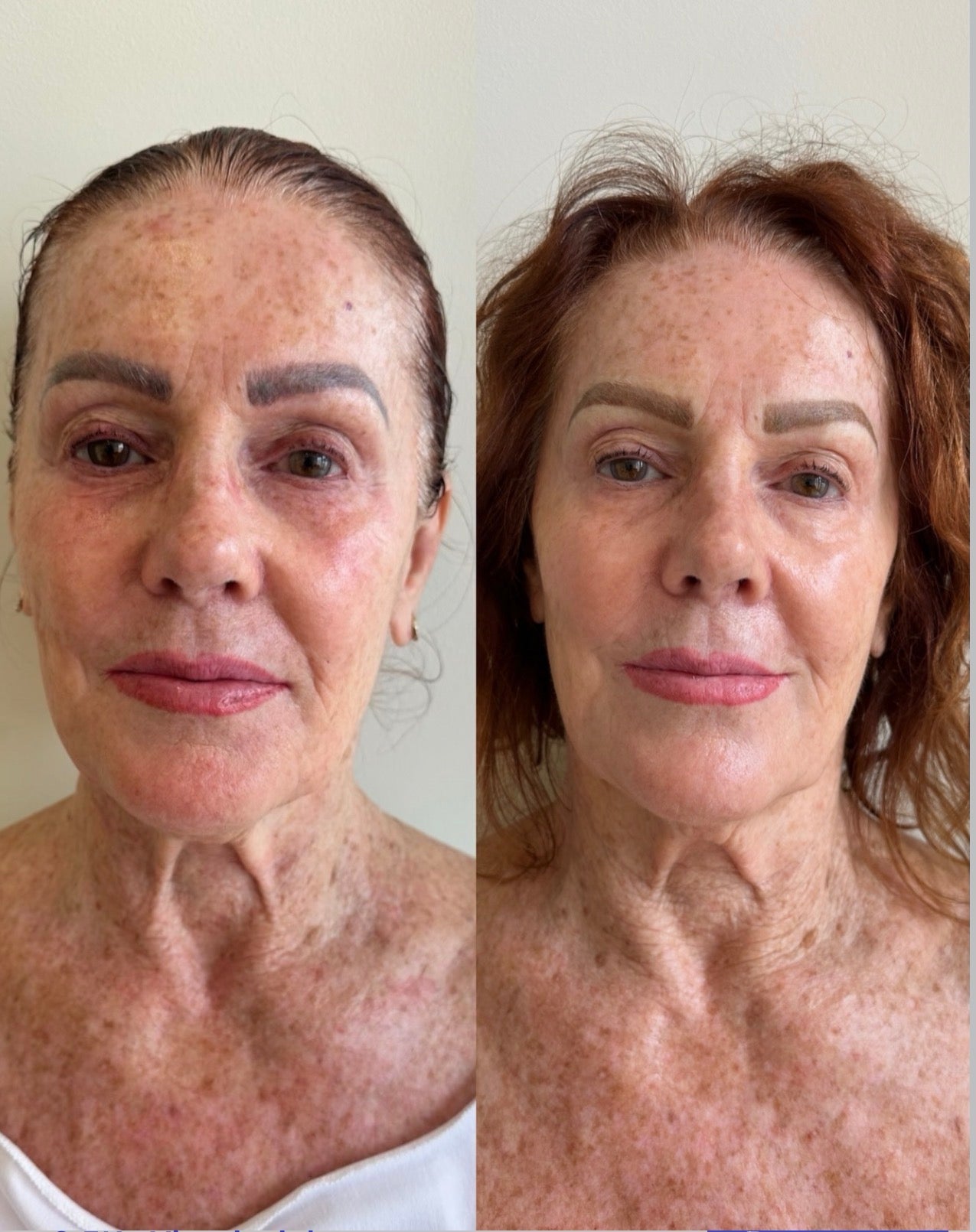 Before and After