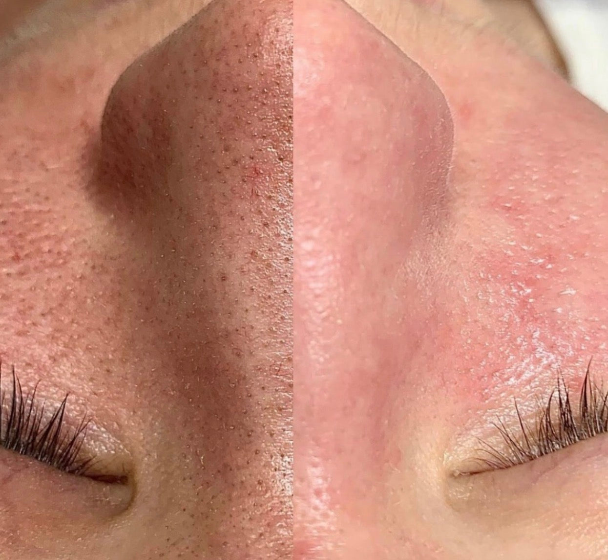 Before and After